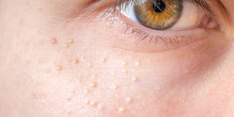 Pele com bolinhas - Créditos: depositphotos.com / vchalup2