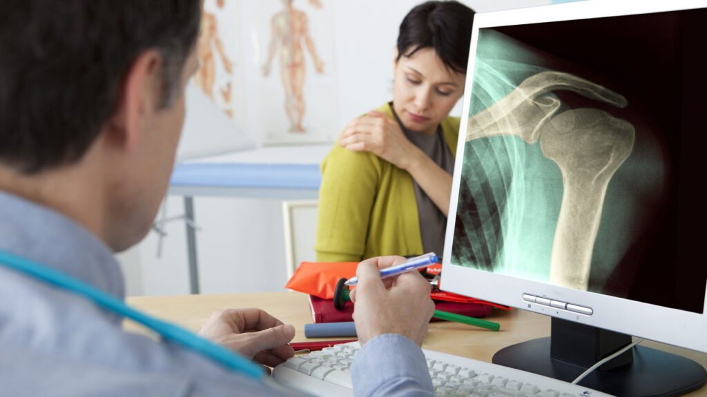 Bursite de ombro atinge atletas e idosos mais do que se imagina