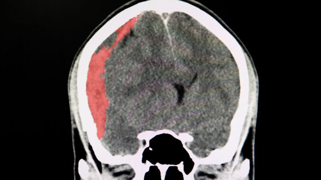 Beber pouca água é perigoso, mas quão perigoso é beber água demais?