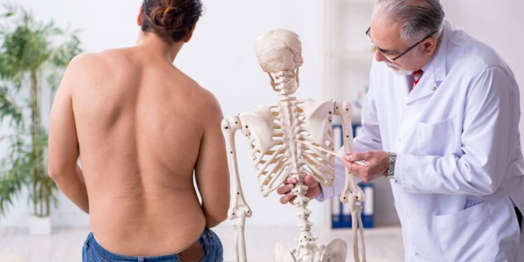 Exercícios certos podem evitar cirurgia em casos de escoliose leve