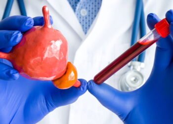 O exame que todo homem deve fazer antes dos 50 anos