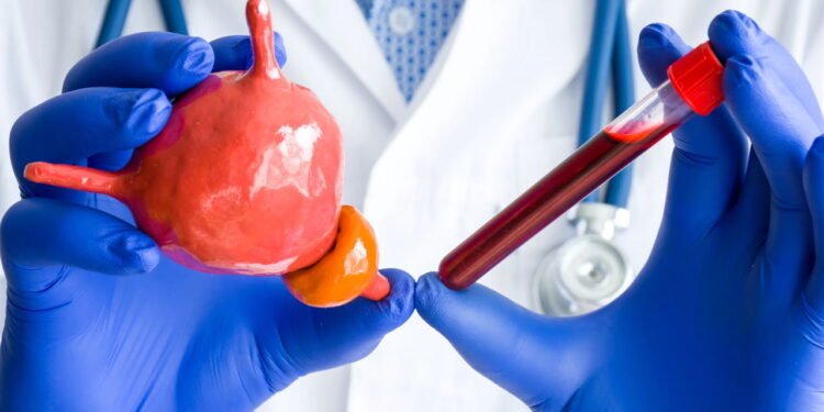 O exame que todo homem deve fazer antes dos 50 anos