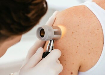 Dr. Patrizio Morisson, Cirurgião: o sinal na pele que pode indicar o câncer mais perigoso