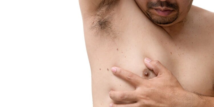 Conheça a técnica para identificar se uma pinta esconde um câncer