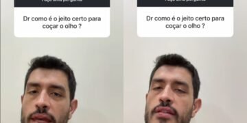 Dr. André Sigueta, Oftalmologista: “Coçar o olho do jeito errado pode causar até descolamento de retina”