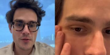 Dr. Ivan Silva, dermatologista, “Sérum não hidrata a pele: entenda por que ele pode deixar sua pele ainda mais seca”