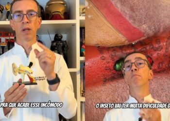 Dr. Carlos Maurício, Otorrino: “O que fazer se um inseto entrar no ouvido”