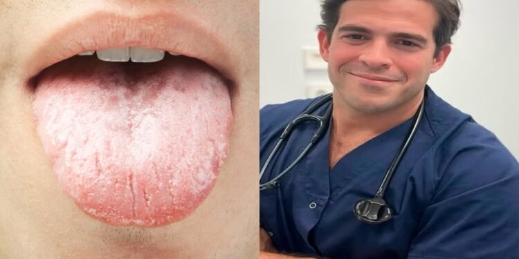 Infecções na boca - Créditos: Aurelio Rojas @doctorrojass / Créditos: depositphotos.com / tiler84