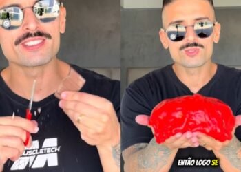 Como proteger seu fígado e reduzir a gordura corporal, segundo o nutricionista Matheus D’Avila