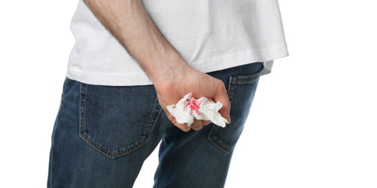 Sangue ao evacuar - Créditos: depositphotos.com / AtlasStudio