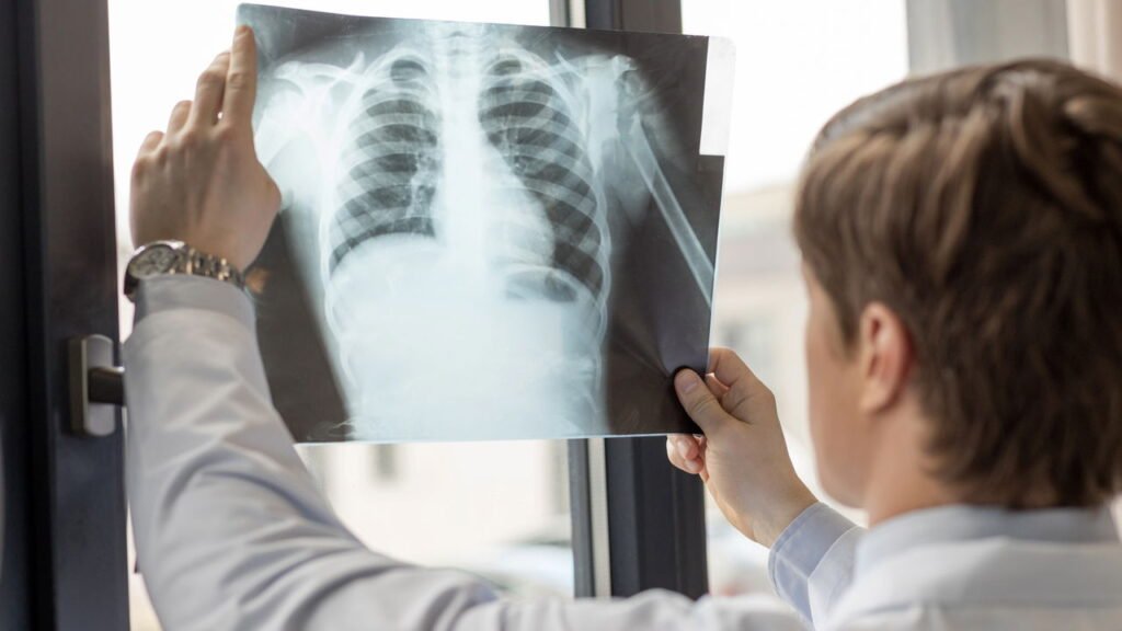 Invenções acidentais que mudaram o mundo de forma surpreendente