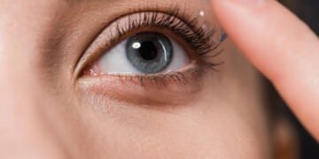 Como evitar catarata e cegueira comendo bem