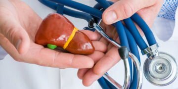 Como prevenir e tratar a gordura no fígado