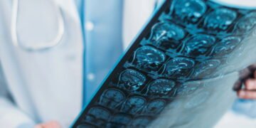 Atlas da Radiologia 2025 o dado mais chocante do SUS