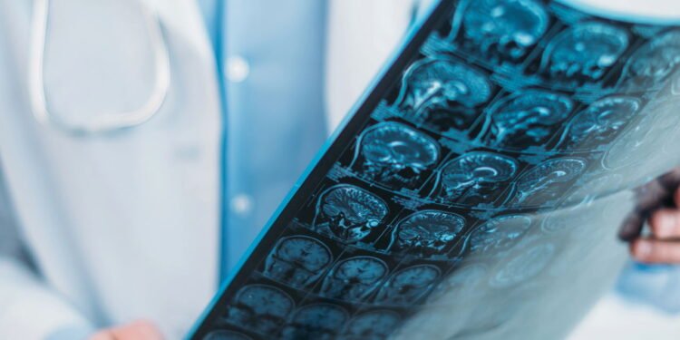 Exames de Imagem - Créditos: depositphotos.com / VitalikRadko