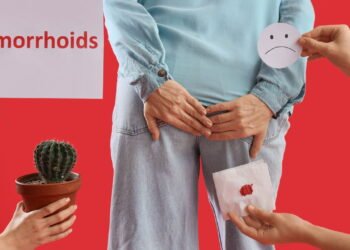 O erro que piora suas hemorroidas sem perceber