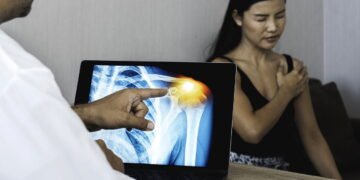 Pequenas dores no ombro podem esconder problemas sérios no manguito rotador