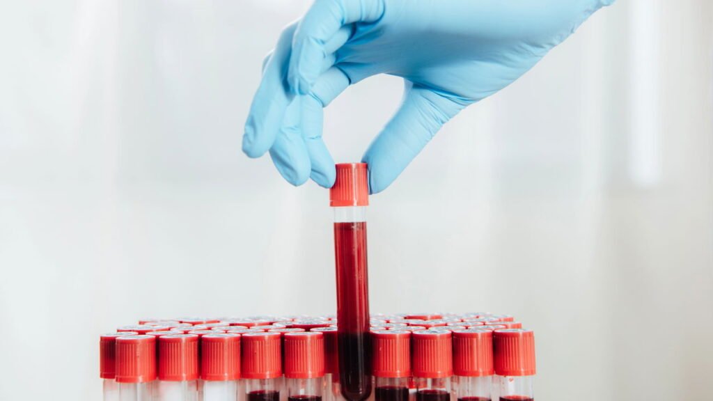 Cientistas revelam possível caminho para reverter o envelhecimento da pele