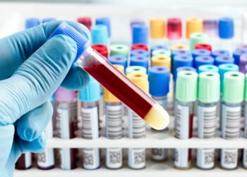 Pesquisadores identificam novo grupo sanguíneo após 50 anos de mistério