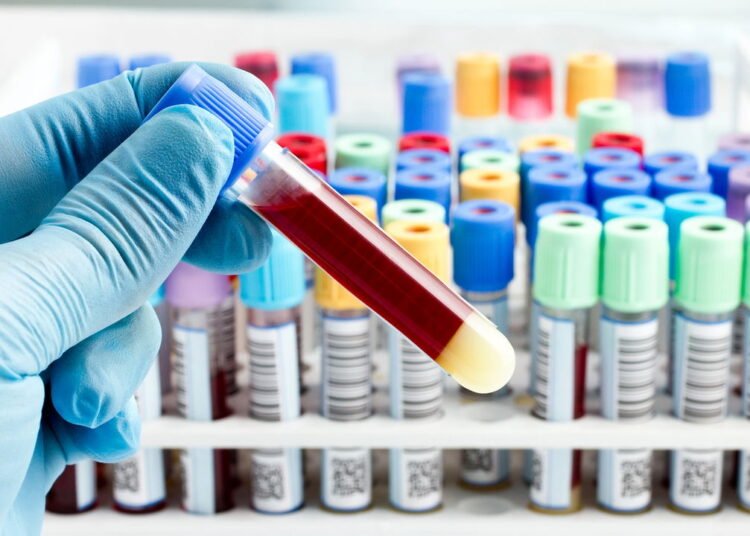 Você sabia que existe uma parte do corpo humano que não recebe sangue ...