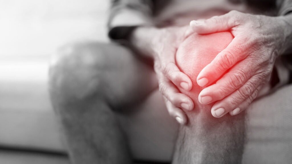 Cientistas descobrem sinal oculto que pode antecipar a artrite reumatoide