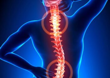 Cirurgia de Coluna: quando a dor nas costas exige mais que tratamento conservador
