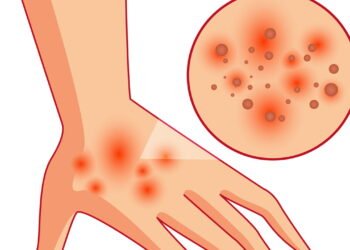 Coceira na mão esquerda pode ser um sintoma preocupante