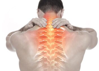 Como aliviar dores causadas por escoliose sem cirurgia usando fisioterapia