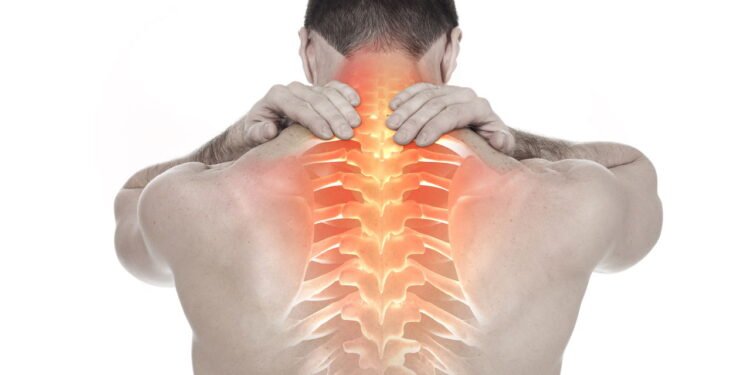 Como aliviar dores causadas por escoliose sem cirurgia usando fisioterapia