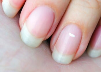 O que significam as manchas brancas na unha
