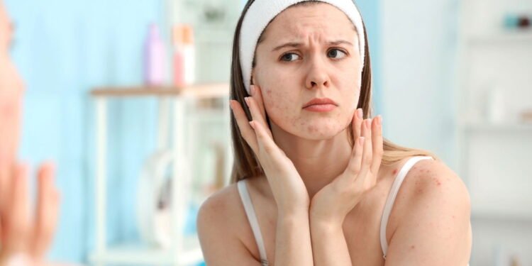 Truques econômicos para hidratar a pele com produtos naturais