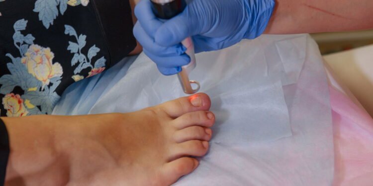 Existem várias opções de tratamento caseiro que podem ser eficazes - Créditos: depositphotos.com / burdun