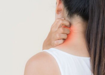 Como eliminar micose em casa com ingredientes simples