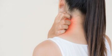 Como eliminar micose em casa com ingredientes simples