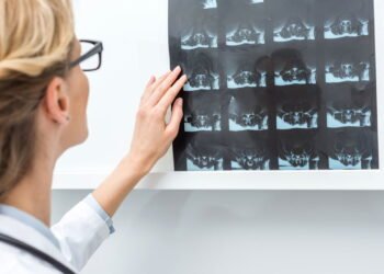 A vitamina essencial para manter seus ossos fortes