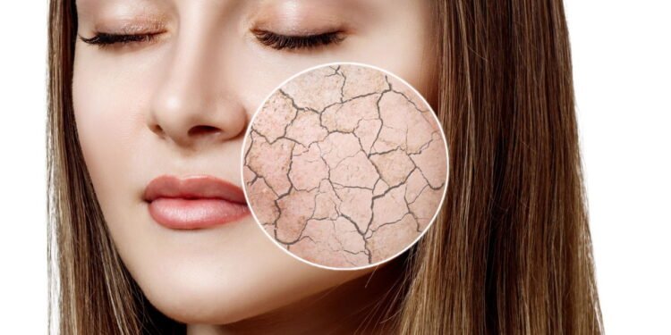 Proteção contra os danos causados por sol e sal - Créditos: depositphotos.com / kotin