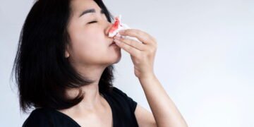 Nariz sangrando com frequência? Conheça as possíveis causas