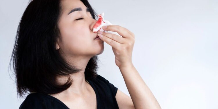 Sangramento nasal - Créditos: depositphotos.com / doucefleur