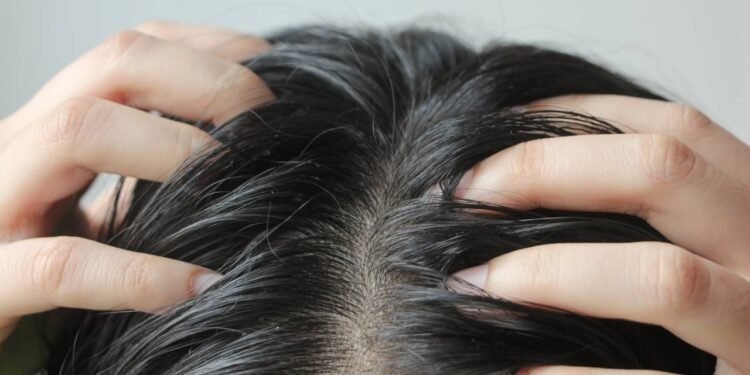 Como acabar com a oleosidade do cabelo em dias quentes