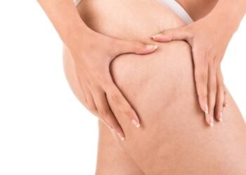 Comecei a comer isso todo dia e minha celulite sumiu em poucas semanas