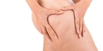 Comecei a comer isso todo dia e minha celulite sumiu em poucas semanas