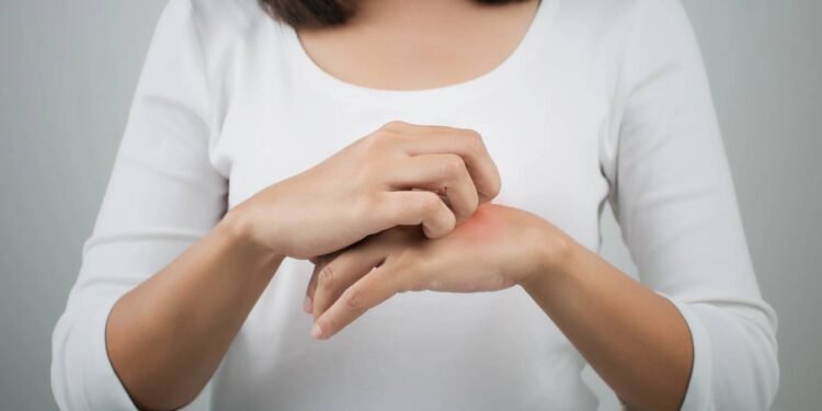 Coceira na Mão Esquerda - Créditos: depositphotos.com / Tharakorn