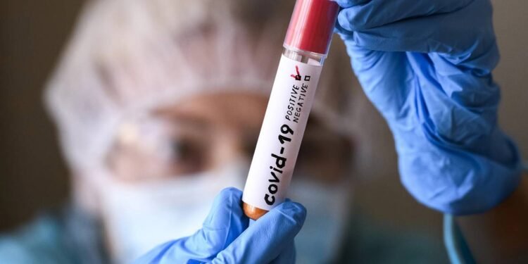 Covid-19 - Créditos: depositphotos.com / Wlad_Mus