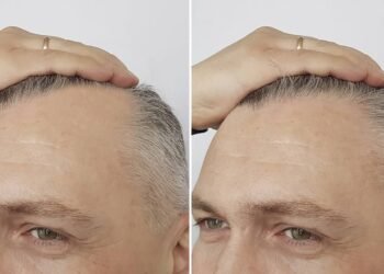 O erro diário que pode estar impedindo seu cabelo de crescer