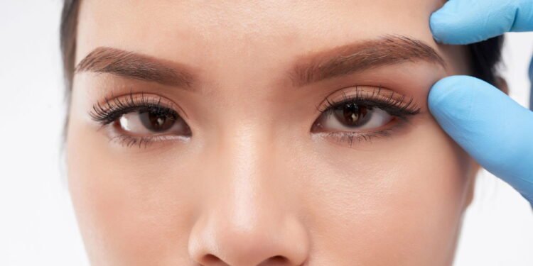 A técnica Fox Eyes consiste em um procedimento estético criado - Créditos: depositphotos.com / DragonImages