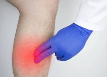 Pernas inchadas? Veja causas e soluções eficazes