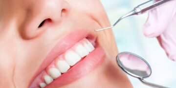 Alimentos que fortalecem os dentes e previnem cáries naturalmente