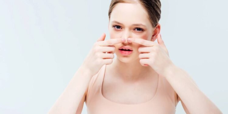 Eliminar acne no nariz - Créditos: depositphotos.com / AndrewLozovyi