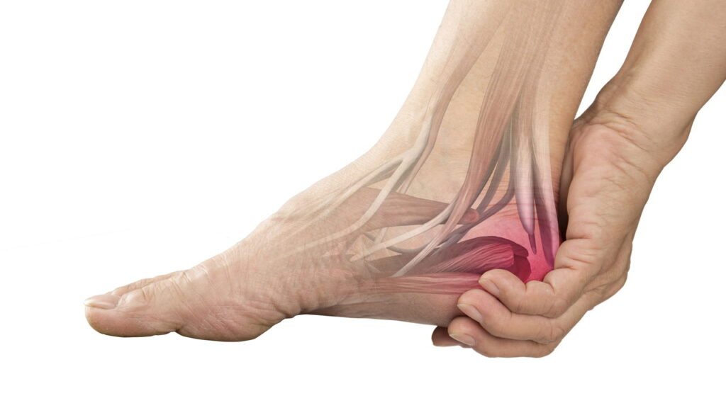 Meu ortopedista ensinou esse jeito fácil de acabar com a dor no calcanhar logo nos primeiros passos do dia