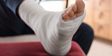 Voltar ao esporte com dor no tornozelo aumenta o risco de nova lesão